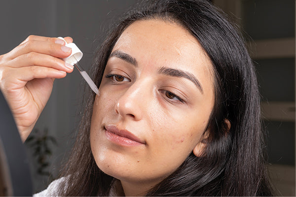 How Can We Take Care of Acne-Prone Skin?